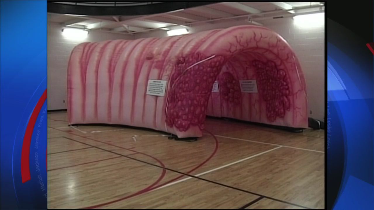 Inflatable colon